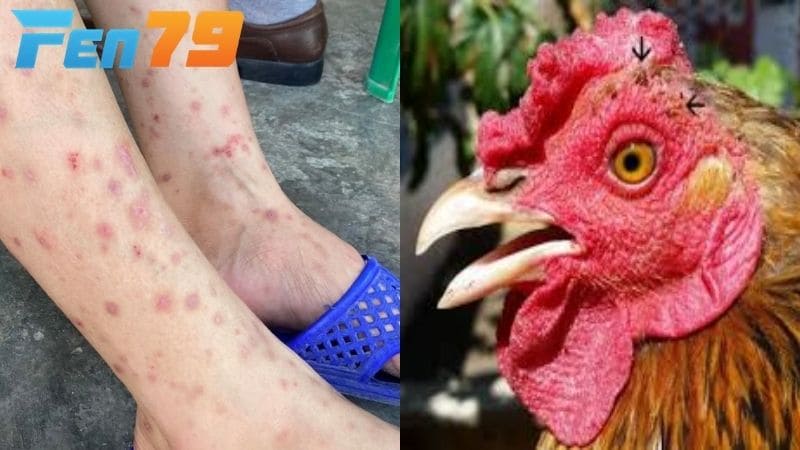 Mạt gà có nhiều tác hại đối với người và cả gia cầm